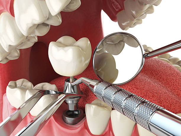 Best Emergency TMJ Treatment in Monson Center, MA